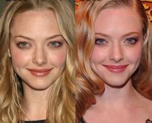 amanda-seyfriend-plastic-surgery
